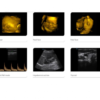 Ultrasound Color Doppler CTS-8800 Plus + 4D convex probe - Image 2