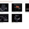 Cardiovascular Color Doppler ECO 5 - Image 6